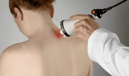 Traitement de l'ostéochondrose cervicale par physiothérapie