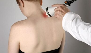 Traitement de la douleur dans la gorge Procédure physiothérapeutique