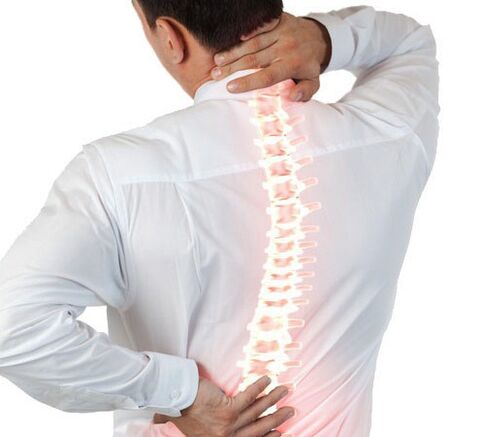 Ostéochondrose de la colonne vertébrale chez un homme